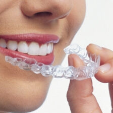 都筑区(都筑ふれあいの丘駅)の歯医者、マサキ歯科クリニックで、マウスピース矯正で話しにくい場合の対処法についての解説