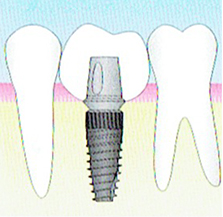 都筑区（都筑ふれあいの丘駅）の歯医者、マサキ歯科クリニックの治療の流れ